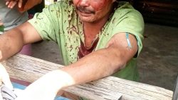 Robert Sihotang Luka Parah Diduga Dikeroyok Di Dairi