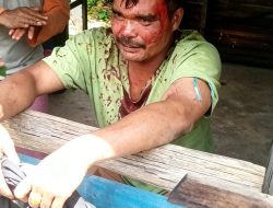 Robert Sihotang Luka Parah Diduga Dikeroyok Di Dairi